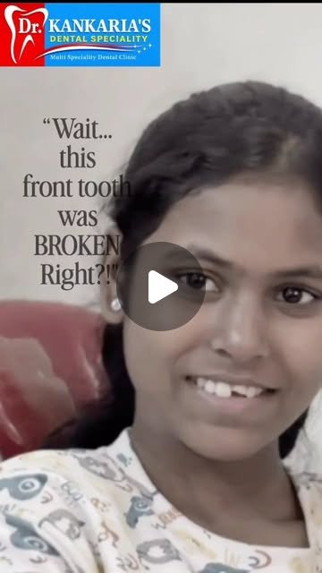 Fractured front tooth smile repair reel
