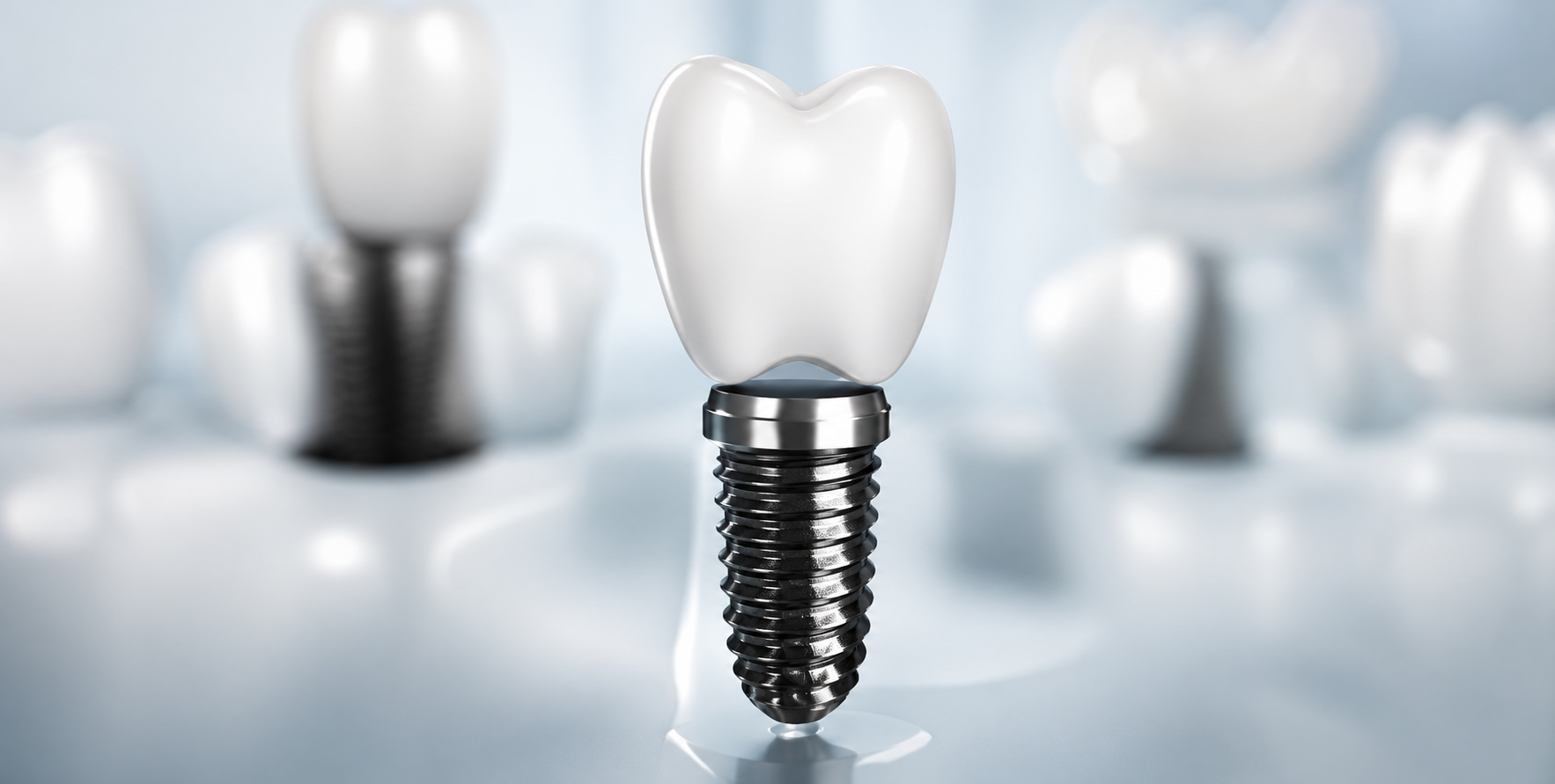 Dental Implants